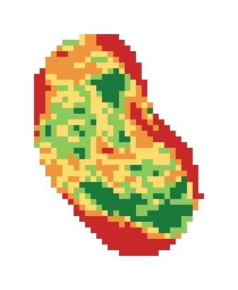 Slope map of the 2nd green at Jonathan's Landing Golf Course