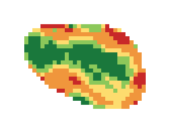 Slope map of the 1st green at Country Club of The South