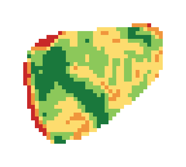 Slope map of the 2nd green at Sunnyside Country Club